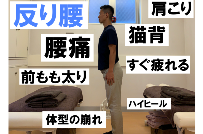 私って反り腰 泉区 戸塚エリアの整体 ボディケア Sunroof 戸塚の整体で雰囲気の良い整体 ボディケア Sunroofのブログ